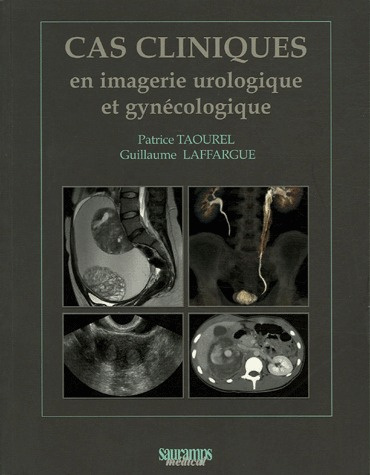 Taourel_Patrice_Laffargue_Guillaume-Cas_cliniques_en_imagerie_urologique_et_gyn_cologique-9782840234388_0