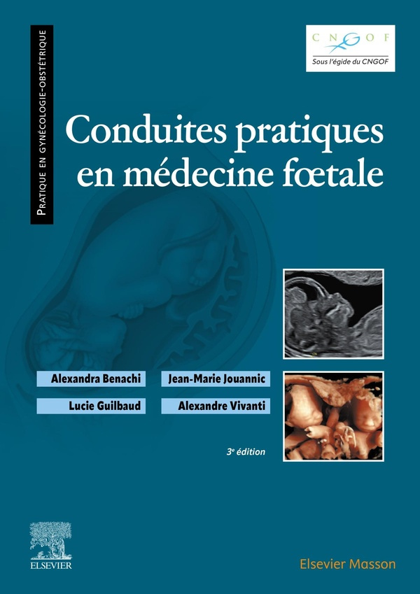 benachi-alexandra-3b-jouannic-jean-marie-3b-guilbaud-conduites-pratiques-en-medecine-foetale_0