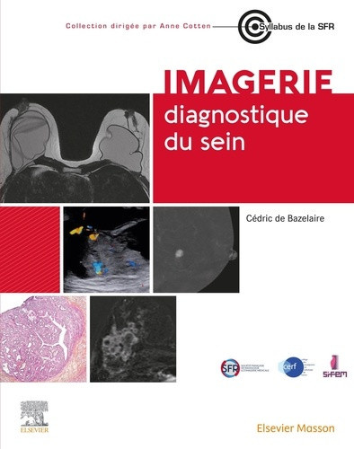 de-bazelaire-cedric-imagerie-diagnostique-du-sein_0