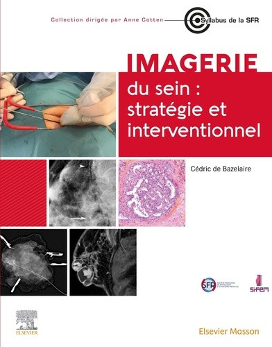 de-bazelaire-cedric-imagerie-du-sein-strategie-et-interventionnel_0
