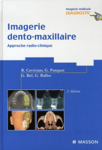 Imagerie dento-maxillaire. Approche radio-clinique, 3e édition - Cavézian Robert ; Pasquet Gérard ; Bel Gilbert ; B