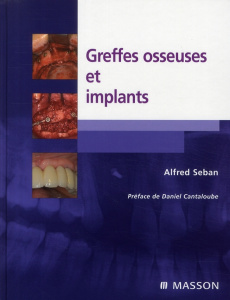Greffes osseuses et implants - Seban Alfred ; Cantaloube Daniel