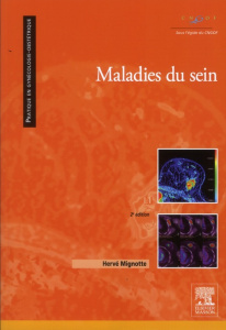 Maladies du sein . 2e édition - Mignotte Hervé ; Fumat Carole