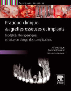 Pratiques clinique des greffes osseuses et implants. Modalités thérapeutiques et prise en charge des - Seban Alfred ; Bonnaud Patrick ; Vacher Christian