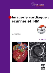 Imagerie cardiaque : scanner et IRM. 2e édition - Vignaux Olivier