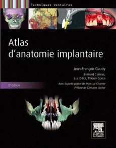 Atlas d'anatomie implantaire. 2e édition - Gaudy Jean-François ; Cannas Bernard ; Gillot Luc