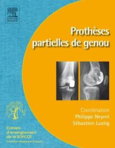 Prothèses partielles du genou - Neyret Philippe ; Lustig Sébastien