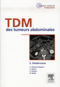 TDM des tumeurs abdominales - Delabrousse Eric ; Aubry S. ; Régent Denis