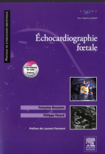 Echocardiographie foetale - Boussion Françoise ; Pézard Philippe ; Fermont Lau