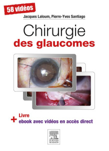 Chirurgie des glaucomes - Laloum Jacques ; Santiago Pierre-Yves