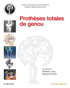 Prothèses totales de genou - Lustig Sébastien ; Parratte Sébastien ; Neyret Phi