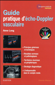 Guide pratique d'écho-Doppler vasculaire - Long Anne