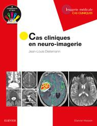 Cas cliniques en neuro-imagerie - Dietemann Jean-Louis