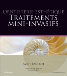 Dentisterie esthétique. Traitements mini-invasifs - Banerjee Avijit ; Lévy Gérard