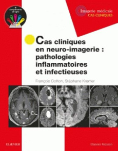 Cas cliniques en neuro-imagerie. Pathologies inflammatoires et infectieuses - Cotton François ; Kremer Stéphane