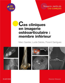 Cas cliniques en imagerie ostéoarticulaire. Membre inférieur - Garetier Marc ; Deloire Lucile ; Garrigues Florent