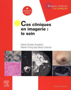 Cas cliniques en imagerie. Le sein - Roedlich Marie-Noëlle ; Bretz-Grenier Marie-Franço
