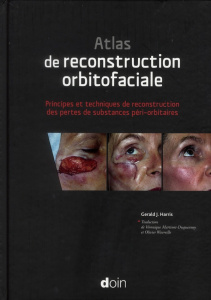 Atlas de reconstruction oculofaciale. Principes et techniques de reconstruction des pertes de substa - Harris Gérald J ; Martinot-Duquennoy Véronique ; W