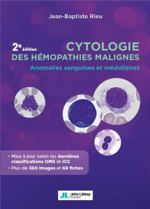 Cytologie des hémopathies malignes. Anomalies sanguines et médullaires - Rieu Jean-Baptiste