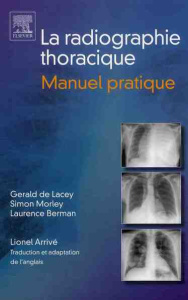 Radiographie thoracique. Manuel pratique - De Lacey Gerald ; Morley Simon ; Berman Laurent ;