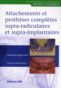 Attachements et prothèses complètes supra-radiculaires et supra-implantaires - Rignon-Bret Christophe ; Mariani Paul