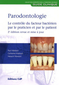Parodontologie. Le contrôle du facteur bactérien par le praticien et par le patient, 2e édition - Mattout Paul ; Mattout Catherine ; Nowzari Hessam