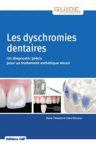 Les dyschromies dentaires. Un diagnostic précis pour un traitement esthétique réussi - Clément Marie ; Marcoux Clara ; Viennot Stéphane