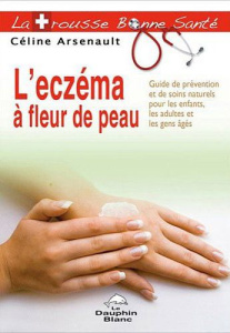L'eczéma à fleur de peau / Guide de prévention et de soins naturels pour les enfants, les adultes et - Arsenault Céline