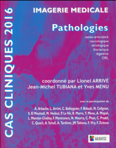 Imagerie médicale. Pathologies ostéoarticulaire, neurologique, sénologique, thoracique, digestive, O - Arrivé Lionel ; Tubiana Jean-Michel ; Menu Yves