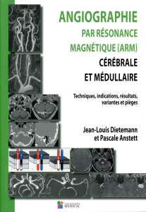 Angiographie par résonance magnétique (ARM) cérébrale et médullaire. Techniques, indications, résult - Dieteman Jean-louis ; Anstett Pascale