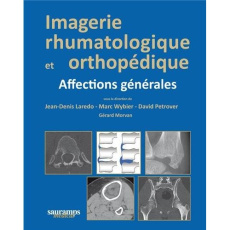Imagerie rhumatologique et orthopédique. Tome 1, Affections générales - Laredo Jean-Denis ; Petrover David ; Wybier Marc ;