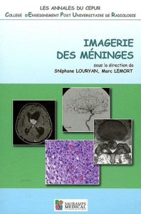 Imagerie des méninges - Louryan Stéphane ; Lemort Marc
