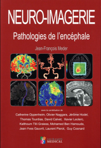 Neuro-imagerie. Pathologies de l'encéphale - Meder Jean-François