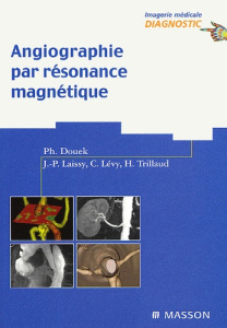 Angiographie par résonance magnétique - Douek Philippe ; Laissy Jean-Pierre ; Lévy Claude