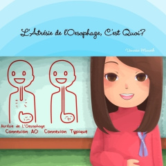 L'Atrésie de l'Oesophage, C'est Quoi? - Munsch Vanessa