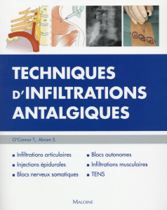 Techniques d'infiltrations antalgiques - O'Connor Therese C ; Abram Stephen E ; Pradel Jean