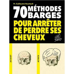 70 méthodes barges pour arrêter de perdre ses cheveux - Heurtault Guillaume