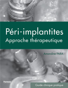 Péri-implantites. Approche thérapeutique - Para Amandine ; Bert Marc ; Jouanneau Claire