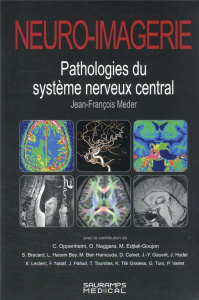 NEURO-IMAGERIE. PATHOLOGIES DU SYSTEME NERVEUX CENTRAL 2ED - Meder Jean-François