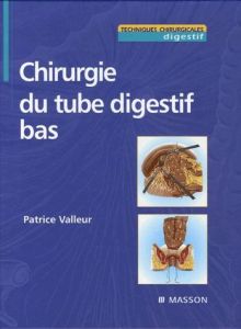 Chirurgie du tube digestif bas - Valleur Patrice