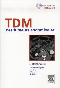 TDM des tumeurs abdominales - Delabrousse Eric - Aubry S. - Régent Denis