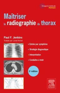 Maîtriser la radiographie du thorax. 2e édition - Jenkins Paul F. - Arrivé Lionel