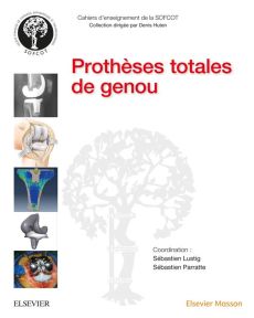 Prothèses totales de genou - Lustig Sébastien - Parratte Sébastien - Neyret Phi