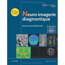 Neuro-imagerie diagnostique. 3e édition - Dietemann Jean-Louis