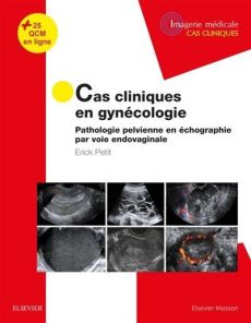 Cas cliniques en gynécologie. Pathologie pelvienne en échographie par voie endovaginale - Petit Erick