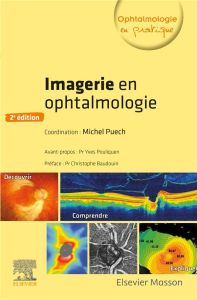 Imagerie en ophtalmologie. 2e édition - Puech Michel - Pouliquen Yves - Baudouin Christoph