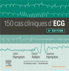 150 cas cliniques d'ECG. 2e édition - Hampton John R. - Adlam David - Hampton Joanna - B