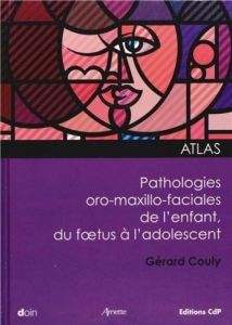 Atlas des pathologies oro-maxillo-faciales de l'enfant, du foetus à l'adolescent - Couly Gérard - Le Douarin Nicole