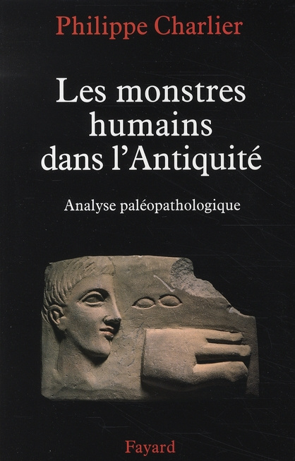 Emprunter LES MONSTRES HUMAINS DANS L'ANTIQUITE - ANALYSE PALEOPATHOLOGIQUE livre