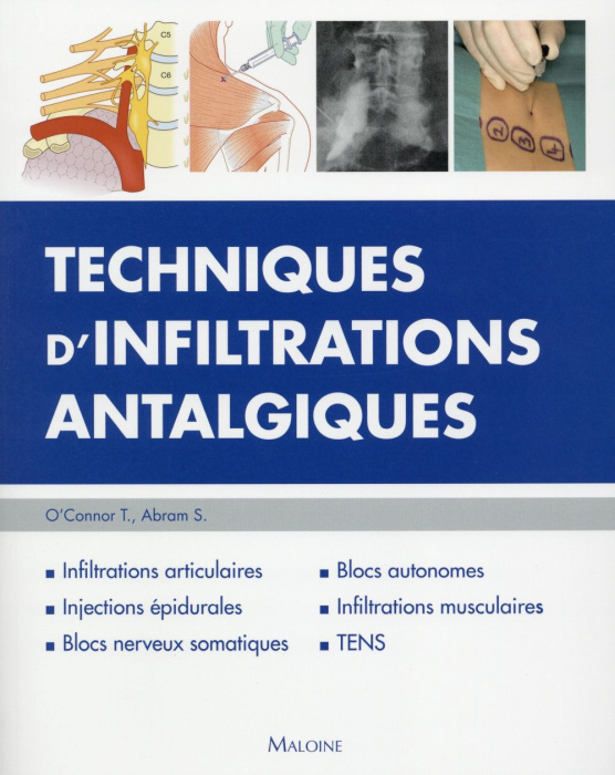 Emprunter Techniques d'infiltrations antalgiques livre